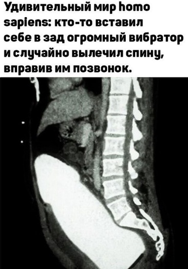 kolarom