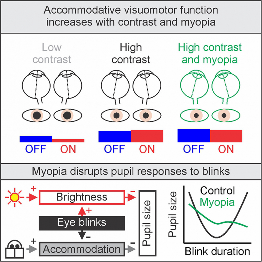 До 2050 року половина людей матиме це захворювання: винні не гаджети, а темний спосіб життя